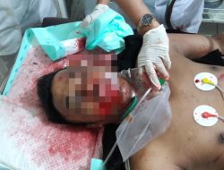 Hilang Kendali, Pengendara Motor Tewas Lakatunggal di Abepura