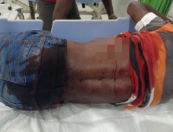 Insiden Penikaman di Pasar Youtefa, Polisi Selidiki Pelaku