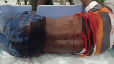 Insiden Penikaman di Pasar Youtefa, Polisi Selidiki Pelaku