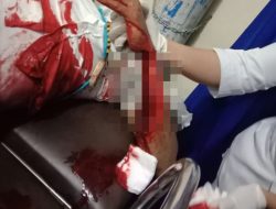 Pembacokan di Jalan Pasar Youtefa, 2 Korban Terluka Motif Belum Diketahui