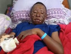 Kisah Siswa SMP Wamena Dibakar Karena Tolak Berdemo Oleh Anggota KNPB Yang Nyaru Jadi Pelajar